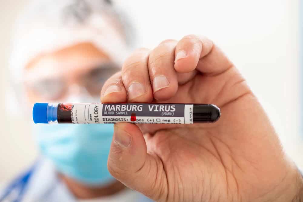 shutterstock_marburg-virus-2